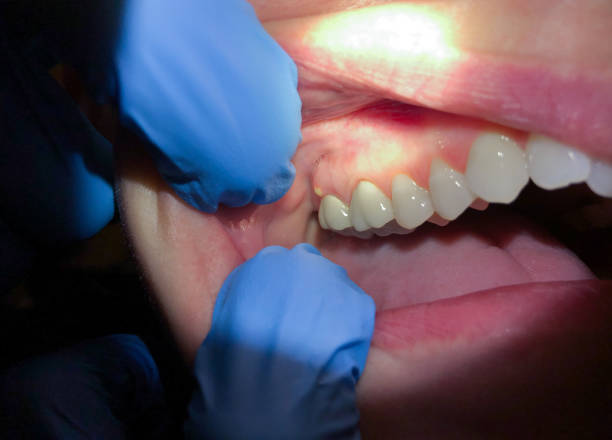  Breckinridge Center, KY Emergency Dentist Pros